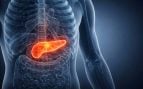 Cáncer