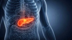 Cáncer