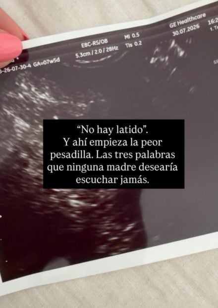 Delicious Martha confirma que ha sufrido la pérdida de su bebé. (Instagram)