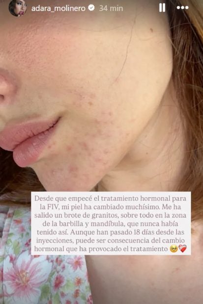 Adara Molinero en su cuenta de Instagram.