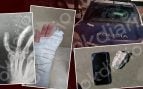 agresiones, policías, Ceuta, inmigrantes ilegales