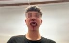 Menor agredido Alaró