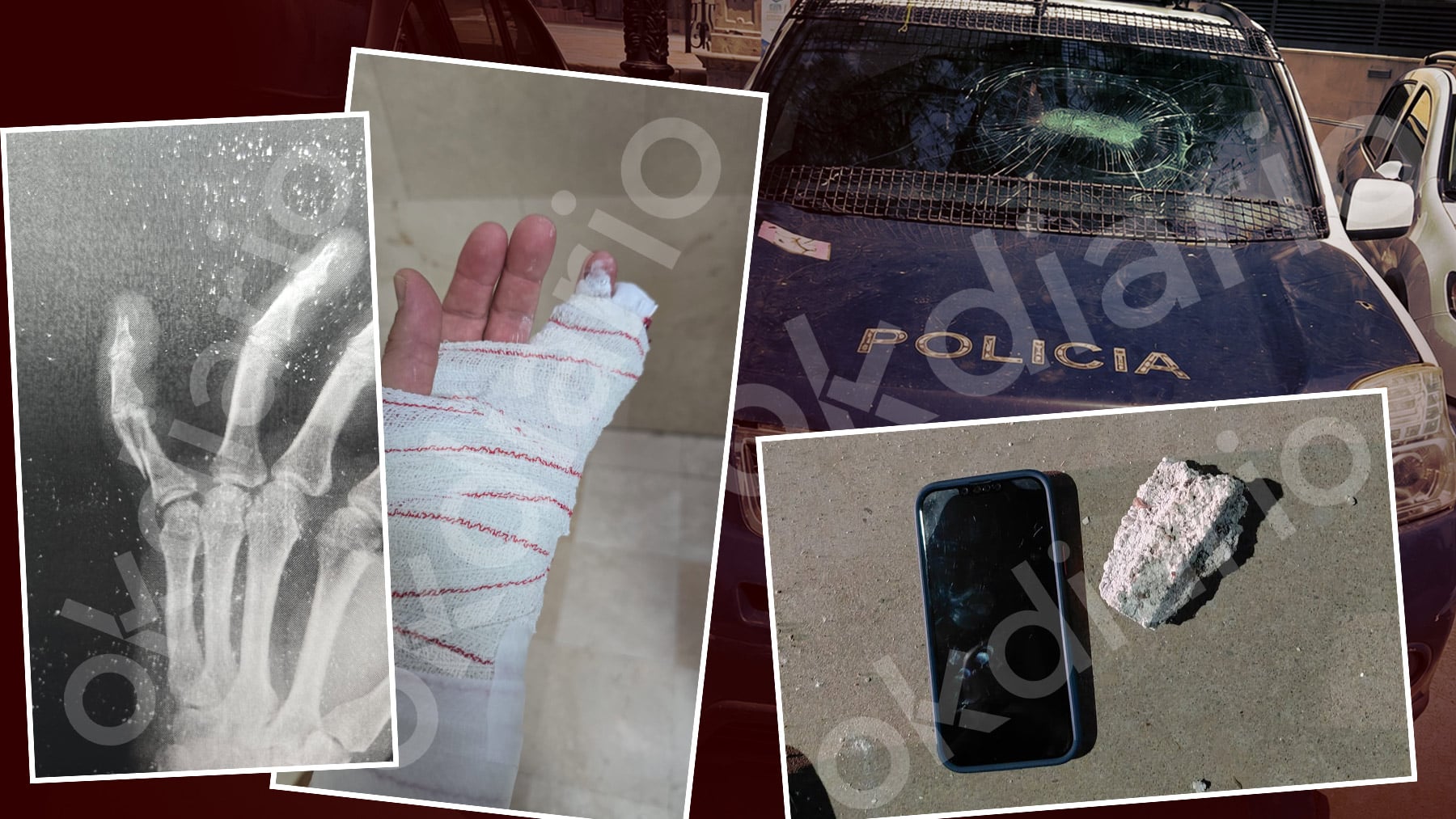 La normalidad en Ceuta: policías con los dedos rotos por las agresiones de los invasores que deambulan por la ciudad