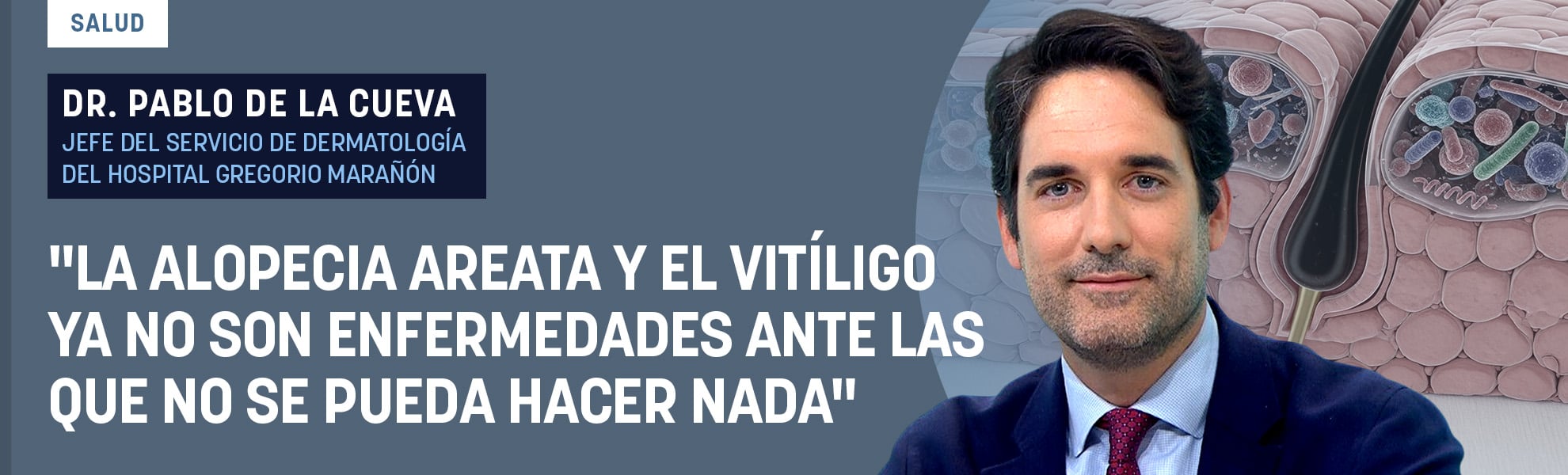 Dr. Pablo de la Cueva: La alopecia areata y el vitíligo ya no son enfermedades ante las que no se pueda hacer nada