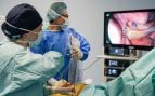 Menos dolor y mayor precisión con la cirugía torácica uniportal de la Dra. Arango en Juaneda Hospitales