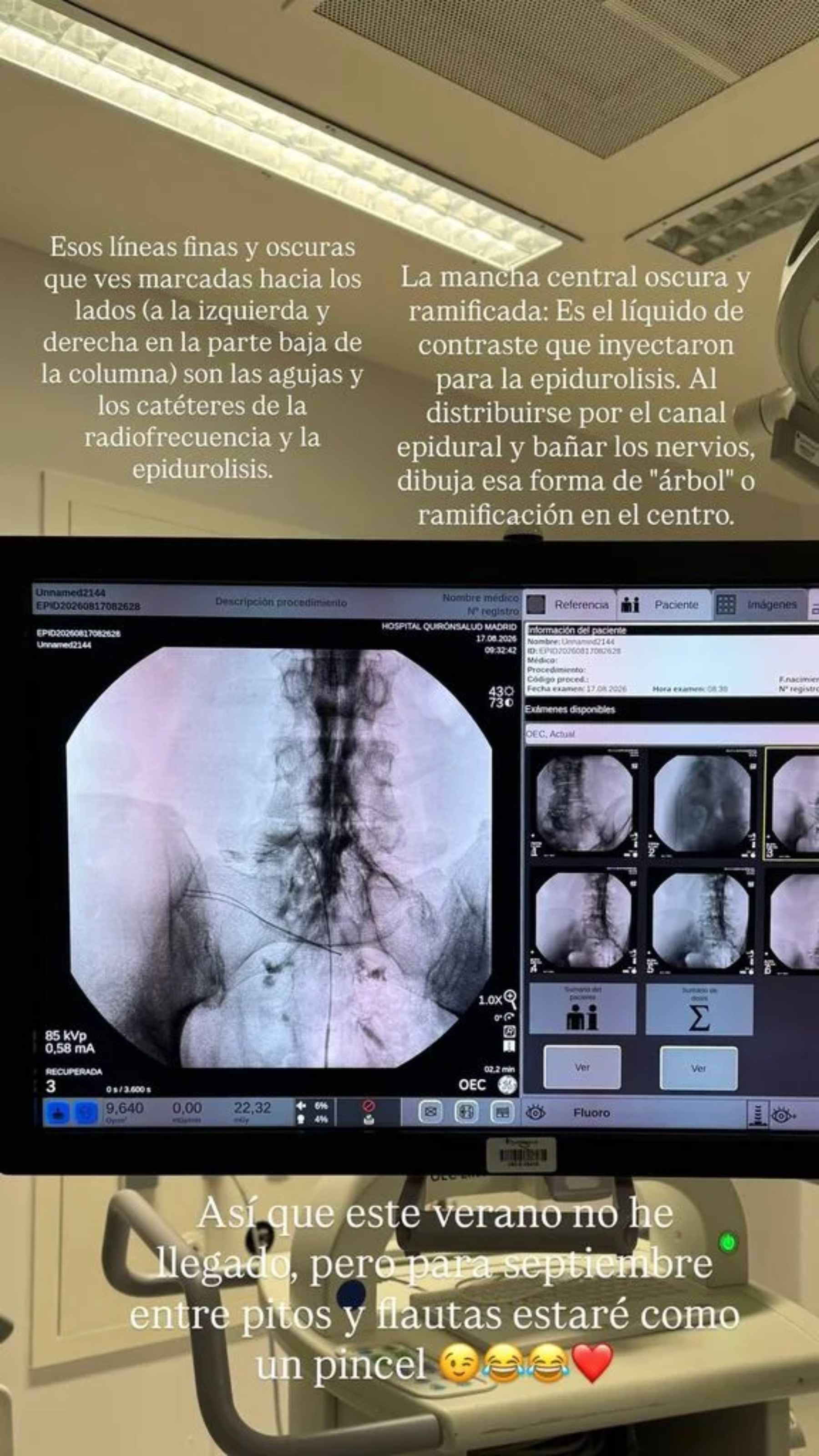 Storie de Instagram de Diego Matamoros. (Foto: Redes Sociales)
