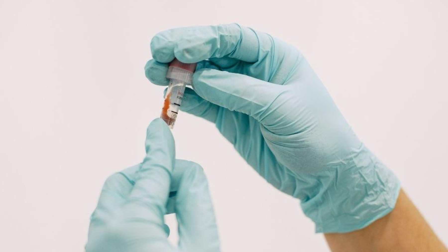 Moderna y Merck anuncian resultados positivos de la vacuna contra el melanoma