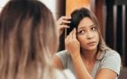 Tricotilomanía: el trastorno de arrancarse el pelo que afecta a más personas de lo que parece