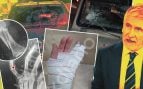 agresiones, ataques, ilegales, Ceuta, policías, militares