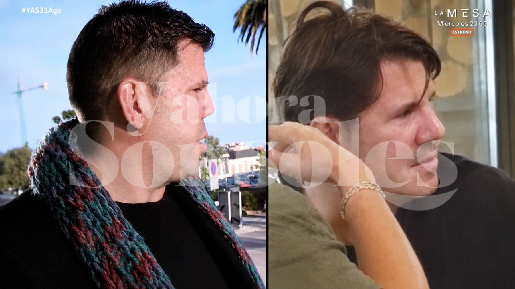 El antes y después de la nariz de Lucas, de Andy y Lucas. (Foto: ‘Y ahora Sonsoles’)