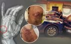 Un policía se rompe la mano en una persecución en coche a un marroquí en Ceuta que iba a prostituir a dos menores