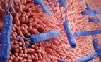 Helicobacter pylori