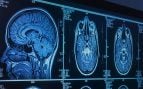 Cerebro de las mujeres