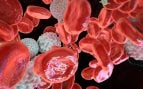 Alertan que en 2027 se diagnosticarán cerca de 28.700 nuevos casos de cáncer hematológico en España