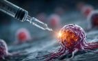 Vacunas contra el cáncer