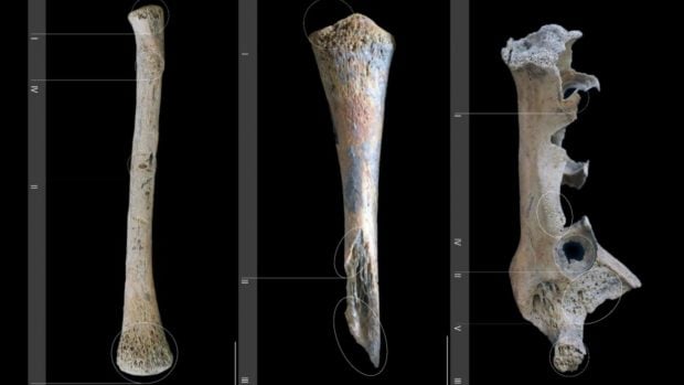 Restos óseos humanos hallados en el sitio de Riparo Alto B (RAB): (a) hemimandíbula derecha, (b) húmero derecho y (c) radio derecho, con las alteraciones tafonómicas y los cambios patológicos marcados con números romanos. Foto: Journal of Archaeological Science: Reports / Omar Larentis