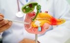 Un ‘entrenamiento’ con ARNm hace que las defensas ataquen el cáncer de páncreas en ratones