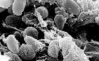 Yersinia pestis, la bacteria causante de la peste, vista al microscopio electrónico en el intestino anterior de una pulga. Foto: Laboratorios Rocky Mountain, NIAID/NIH, dominio público