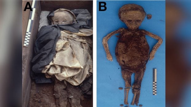La momia infantil hallada en la bas&iacute;lica de San Domenico Maggiore, en N&aacute;poles, con su vestido funerario en el ata&uacute;d (izquierda), y el cuerpo momificado antes de la autopsia (derecha). Foto: Patterson Ross et al. - PLOS Pathogens, CC BY 4.0