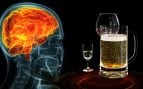 Dejar el alcohol también cambia el cerebro: así es la pista que puede explicar algunas recaídas