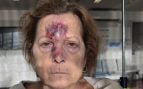 Peligro en las aceras del Arenal: una vecina sufre un fuerte golpe en la cabeza al caerse cuando iba al centro de mayores