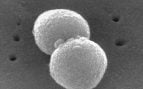 Inteligencia artificial contra el neumococo: micrografía electrónica de Streptococcus pneumoniae