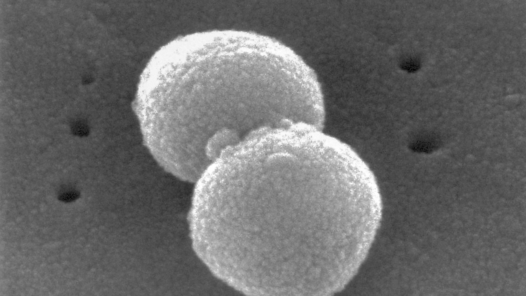 Una inteligencia artificial revisa 6.747 fármacos y da con un antibiótico veterinario que, en el laboratorio, frena al neumococo multirresistente