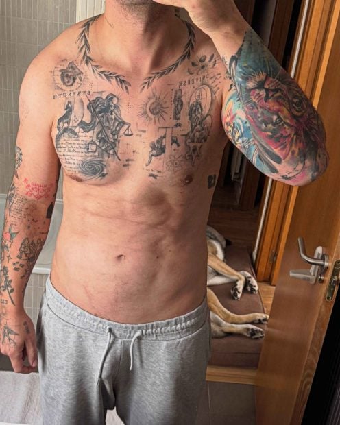 Diego Matamoros enseña el resultado de su ginecomastia (Foto: Instagram).