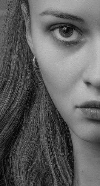 blefaroplastia cirugía estética