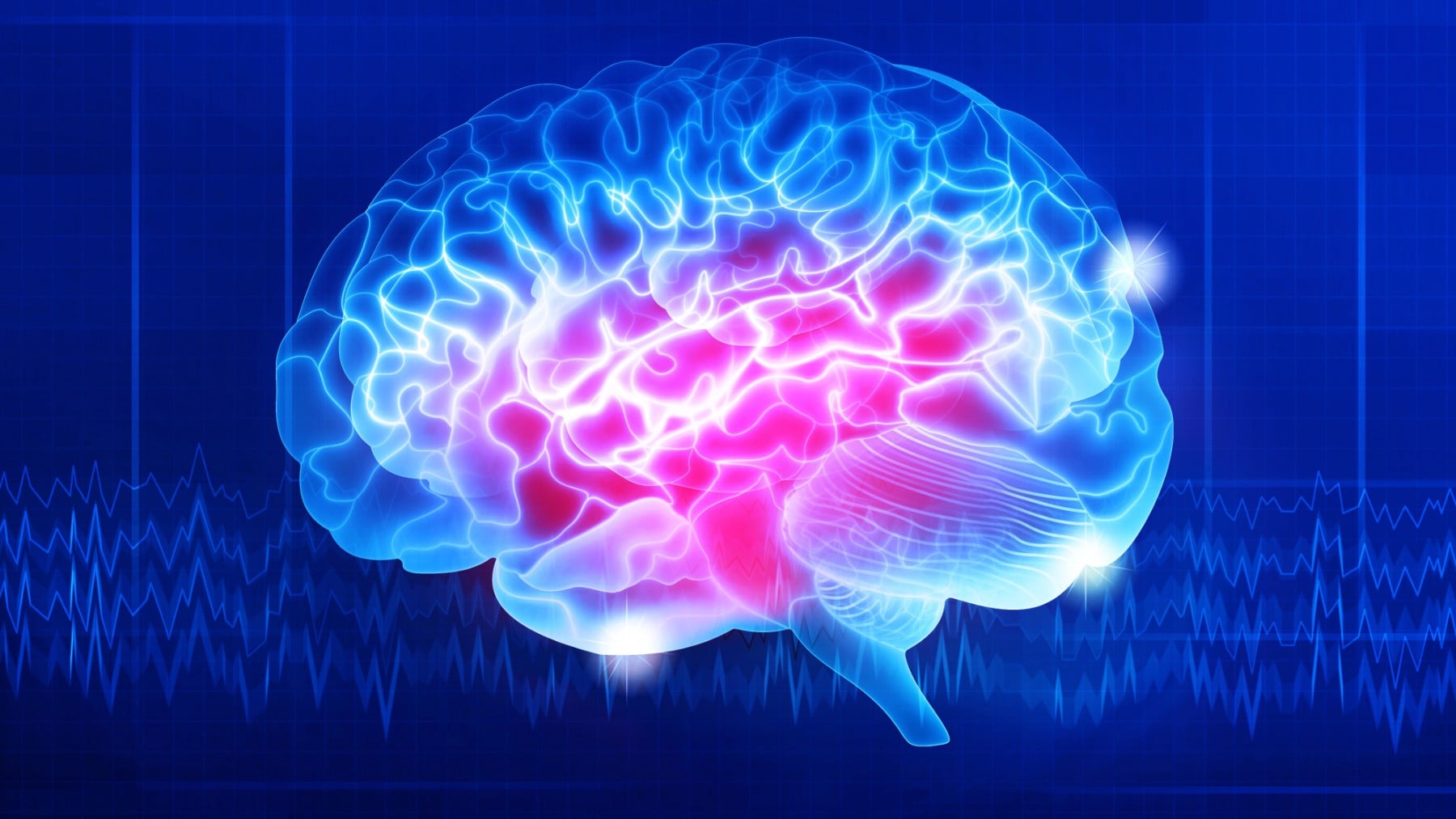 Zona cerebral donde se ha producido un ictus.