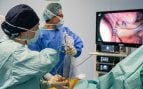 Intervención pulmonar mínimamente invasiva, con recuperación rápida y segura, en Juaneda Hospitales