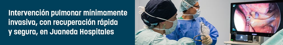 Intervención pulmonar mínimamente invasiva, con recuperación rápida y segura, en Juaneda Hospitales