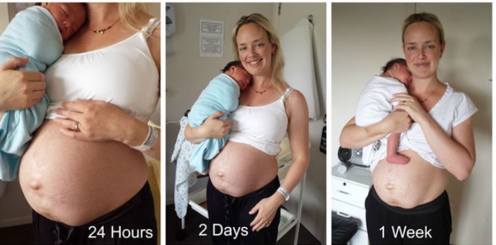 Nuevo viral: las imágenes de una mujer durante su embarazo y después del mismo