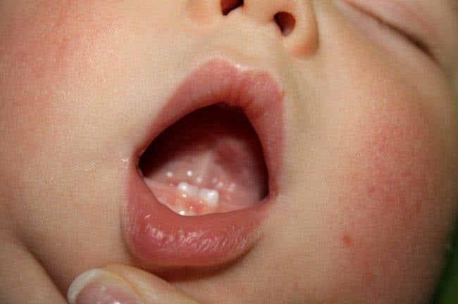 El proceso de dentición de tu bebé. Todo lo que necesitas saber