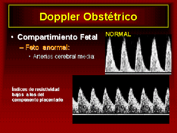 doppler-2
