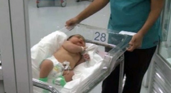 Nacen Dos Bebes De Mas De 5 5 Kilos De Peso