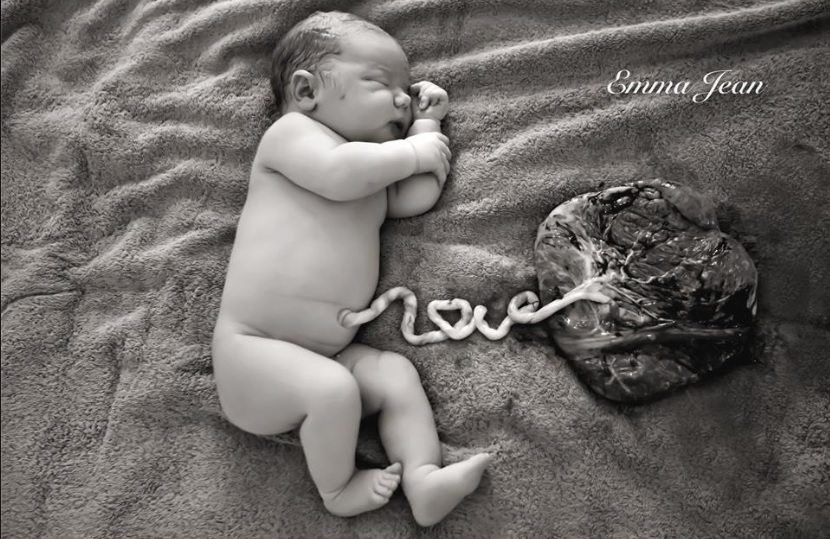 La fotografía de un bebé unido a su placenta se hace viral