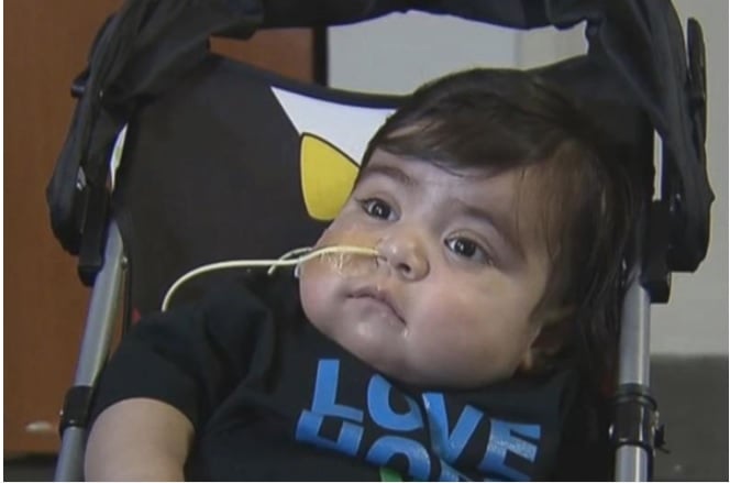 Liam, el bebé que ha sobrevivido al trasplante de ocho órganos