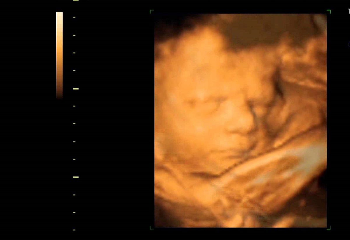 Una clínica da las mismas ecografías 3D a varias embarazadas