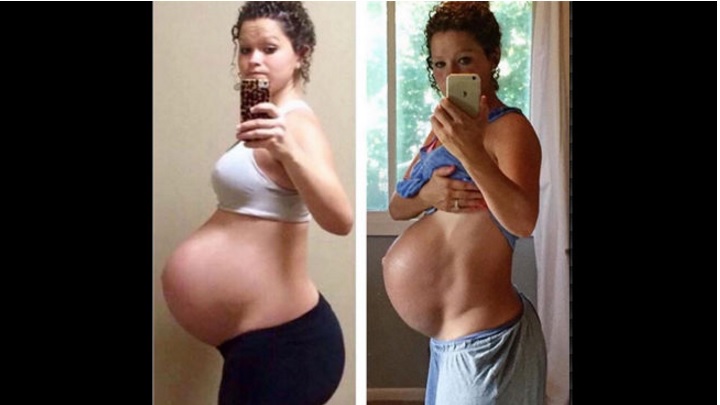 Viral: mamá fitness compara sus dos embarazos para defender el deporte