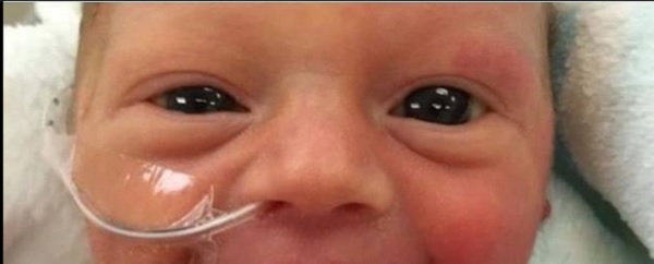 Viral: la imagen de una bebé prematura que te enternecerá. Descúbrela