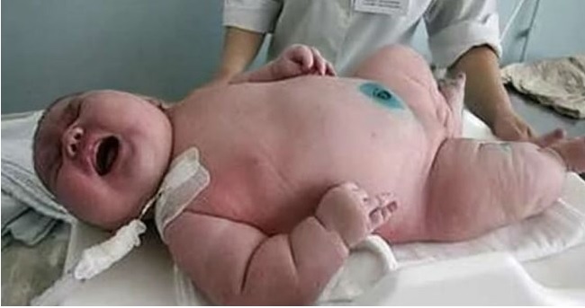 Una mujer dió a luz a un bebé de 18 kilos