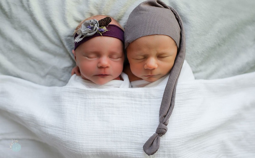 Viral: emotivas fotos de dos gemelos antes de que uno muriera