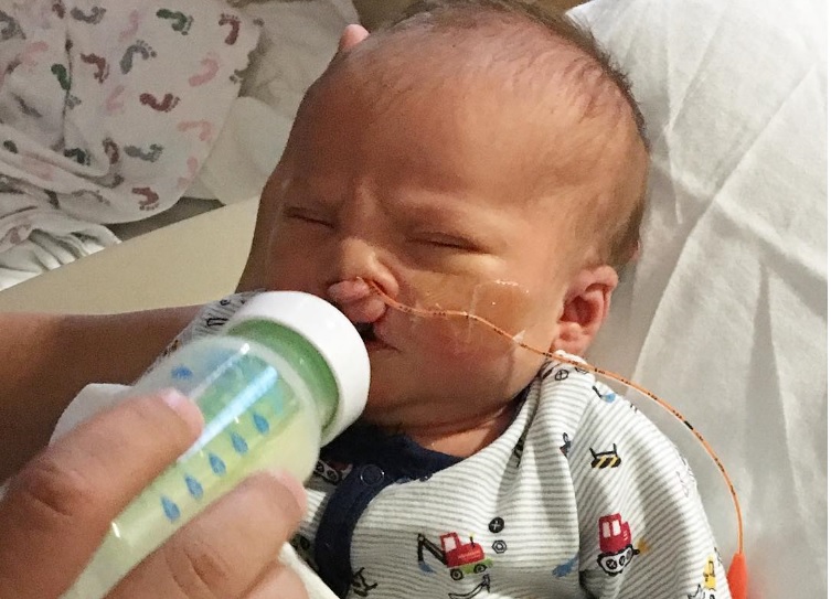 Bebé con labio leporino, del que se burlaban, es operado gracias a una donación