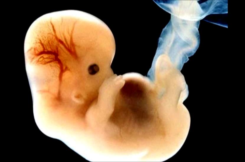 Desarrollo De Un Bebe De 8 Meses De Gestacion