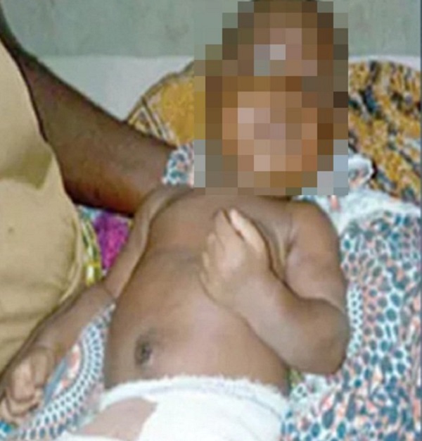 Bebé fallecido tras haberle cortado el pene la novia de su padre