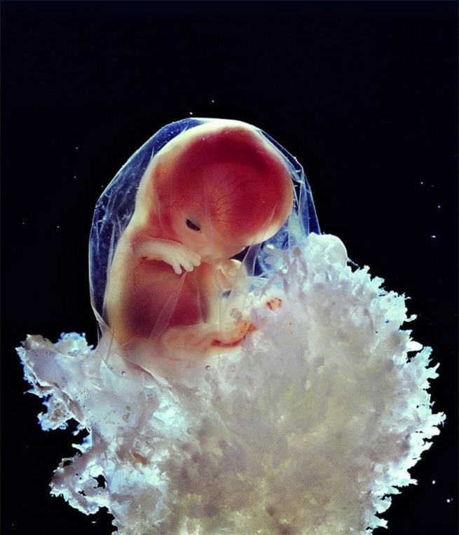 Gestación humana a través de imágenes sobre el embarazo