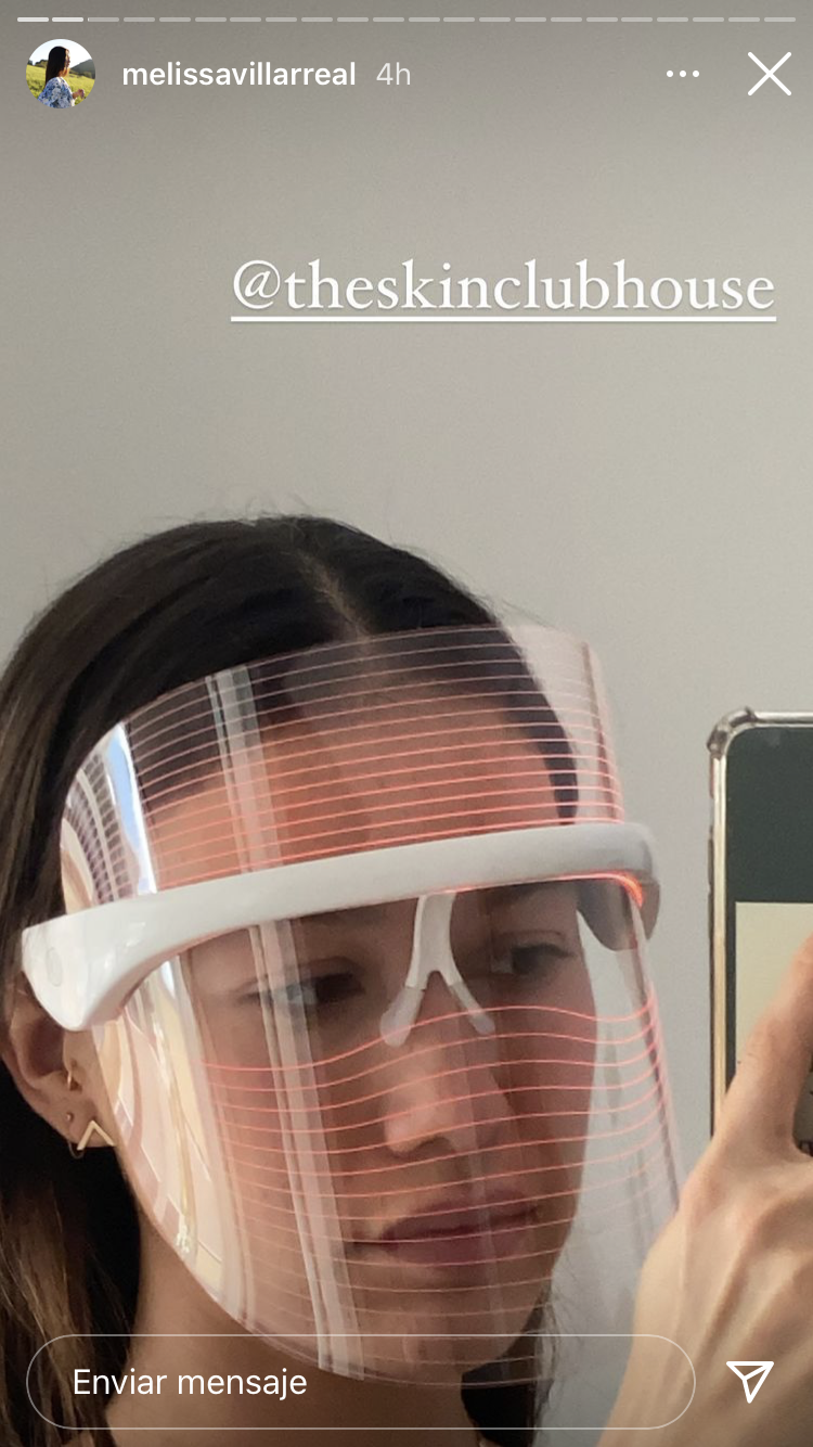 Acné