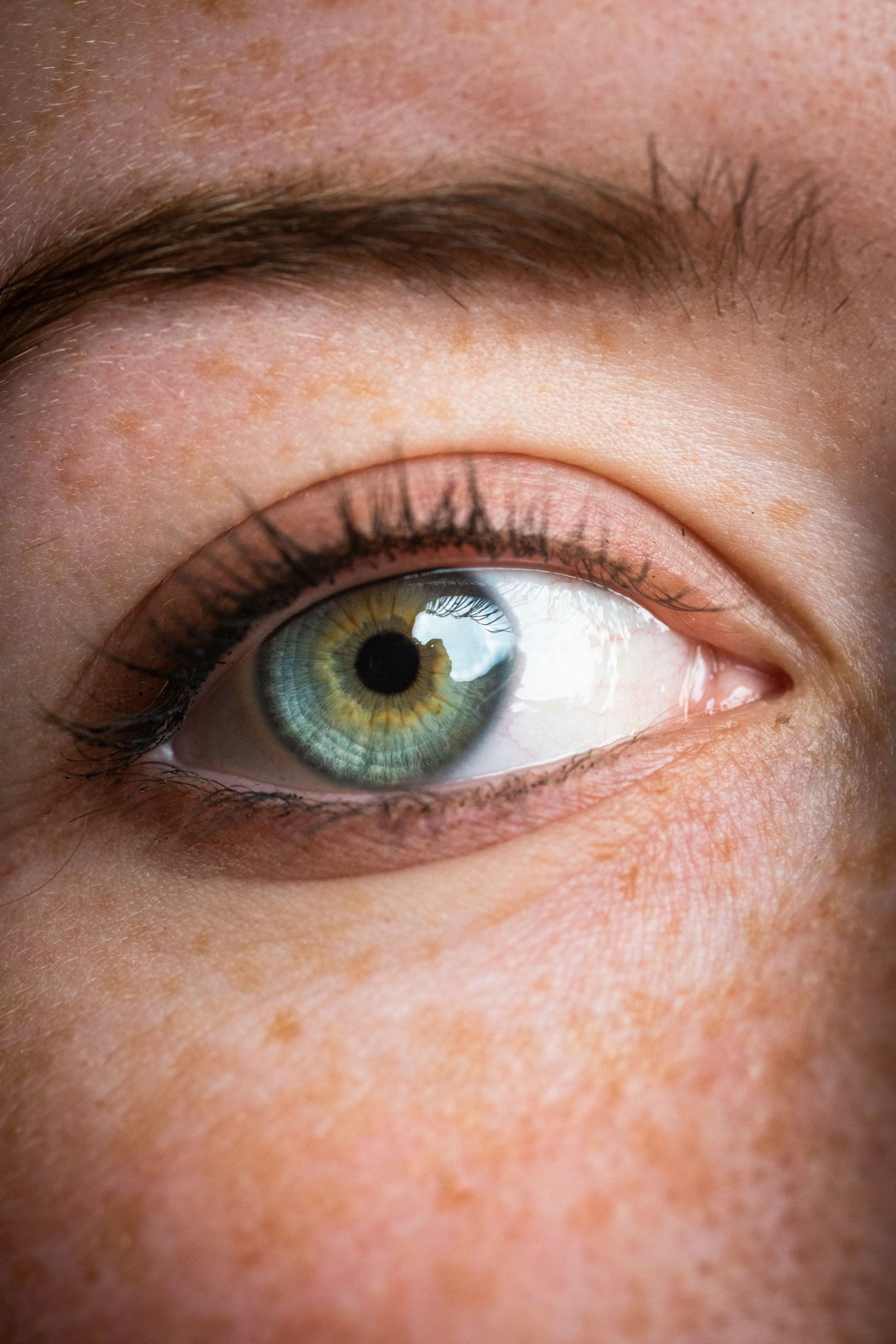 Ojo