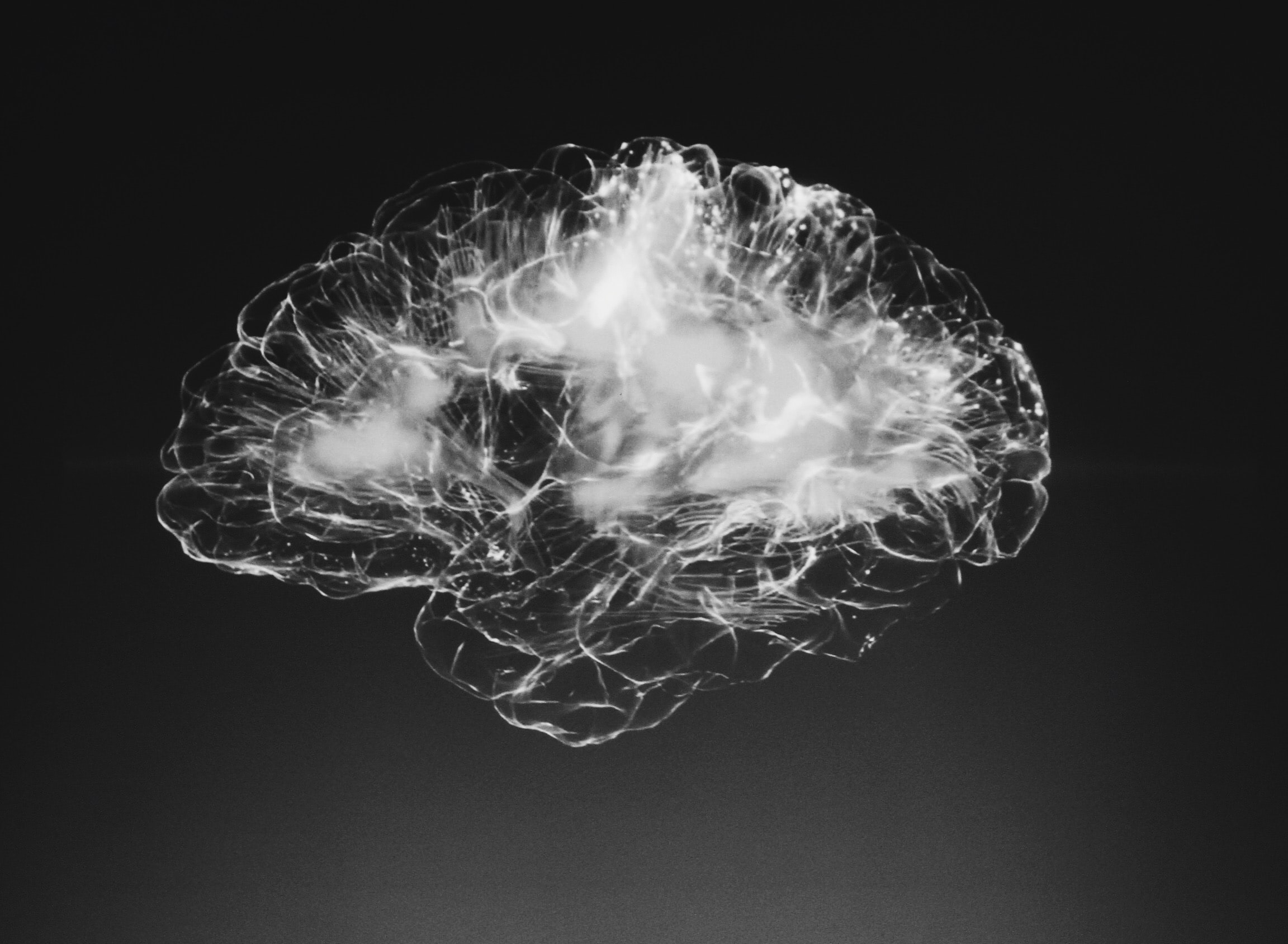 Cerebro